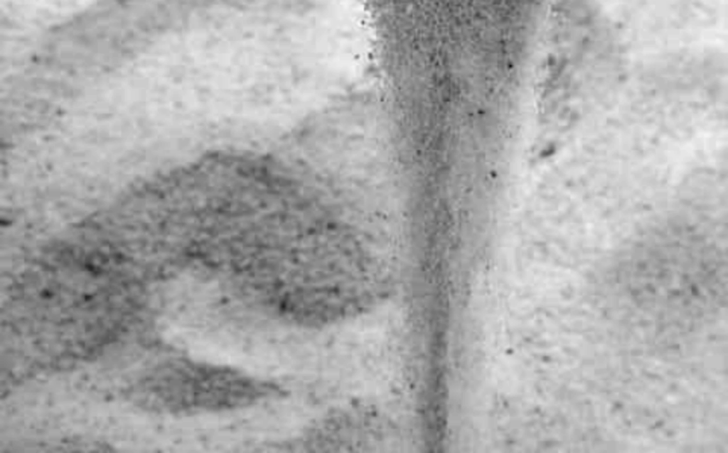 Grain of Sand in the&nbsp;Desert